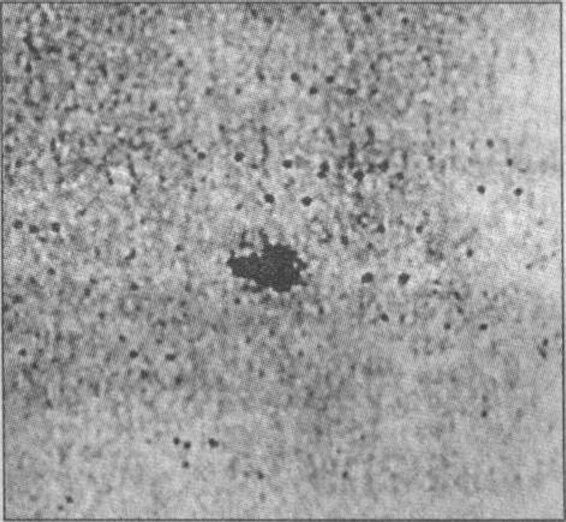 Рис. 52. Таинственный объект, сфотографированный Э. Герцшпрунгом 15 декабря 1900 г. (негатив). Было сделано 2 экспозиции со сдвижкой телескопа, так что объект и звезды дали по 2 изображения, смешенные по горизонтали и разнесенные приблизительно на 22 мин по времени