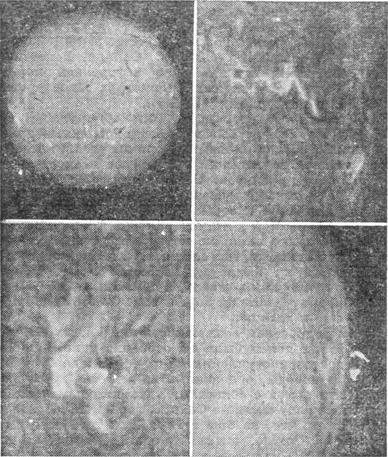 Рис. 135. Фотографии четырех солнечных вспышек в свете бальмеровской линии водорода H<sub>α</sub>