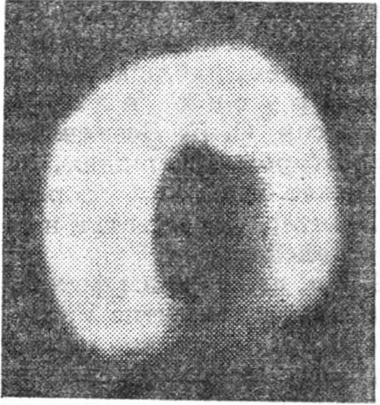 Рис. 64. Кольца Урана. Вверху показано, как кольца последовательно затмевали свет звезды, что и привело к их открытию. Черточка под диском планеты означает масштаб — 10000 км (слева). Справа изображена часть колец в увеличенном виде. (Рисунки заимствованы из журнала Sky and Telescope, 1977, v. 33, No. 6.) Внизу — фотография колец Урана, полученная на обсерватории Маунт Паломар. (Снимок из журнала Science et vie, 1978, Nr. 739.)